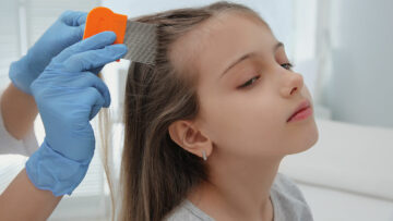 Kopfläuse richtig behandeln